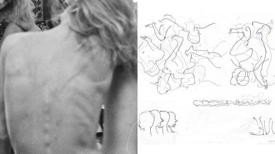 Two images are placed side by side. On the left, a grainy black-and-white photograph shows a bare back; the spine is clearly visible, with the head tilted forward and partly outside the frame. On the right, a drawing on white paper features delicate, overlapping lines: sketch-like bodies, arms, legs, and profiles are suggested in various positions, some fragmented and some appearing in motion.